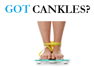 Got Cankles? How To Get Rid Rid of Cankles Without Surgery